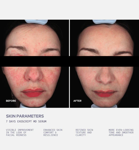 ExoScript MD™ Biomimetic Renewal Face Serum