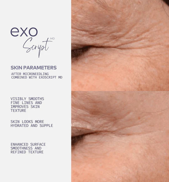 ExoScript MD™ Biomimetic Renewal Face Serum