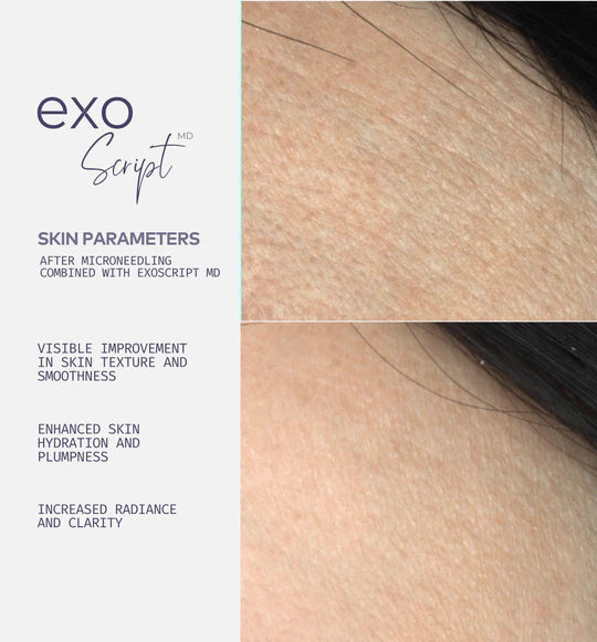 ExoScript MD™ Biomimetic Renewal Face Serum